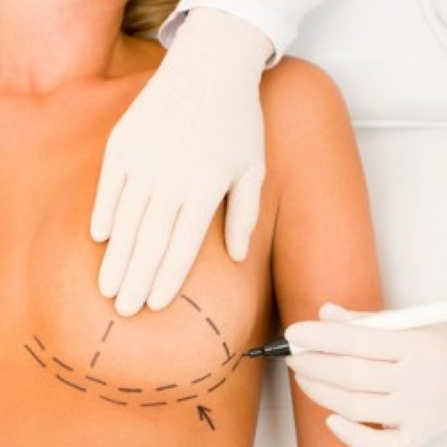 Breast reconstruction is law